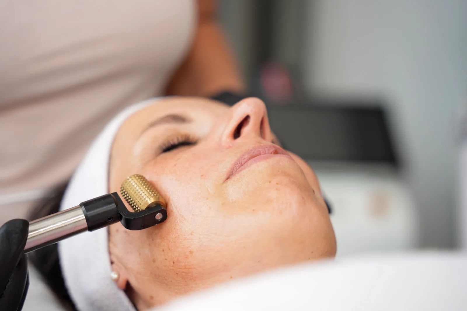 Erlebnispaket Microneedling – Bild 7